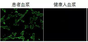 間接免疫熒光