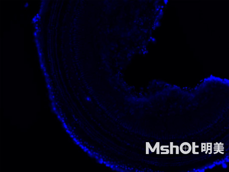 倒置熒光顯微鏡應(yīng)用于小鼠耳蝸觀察