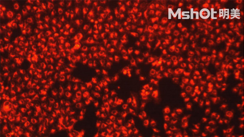 熒光生物顯微鏡應用于ANA-HEp2免疫熒光診斷