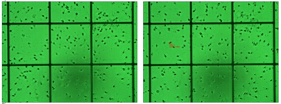精子顯微檢測(cè)